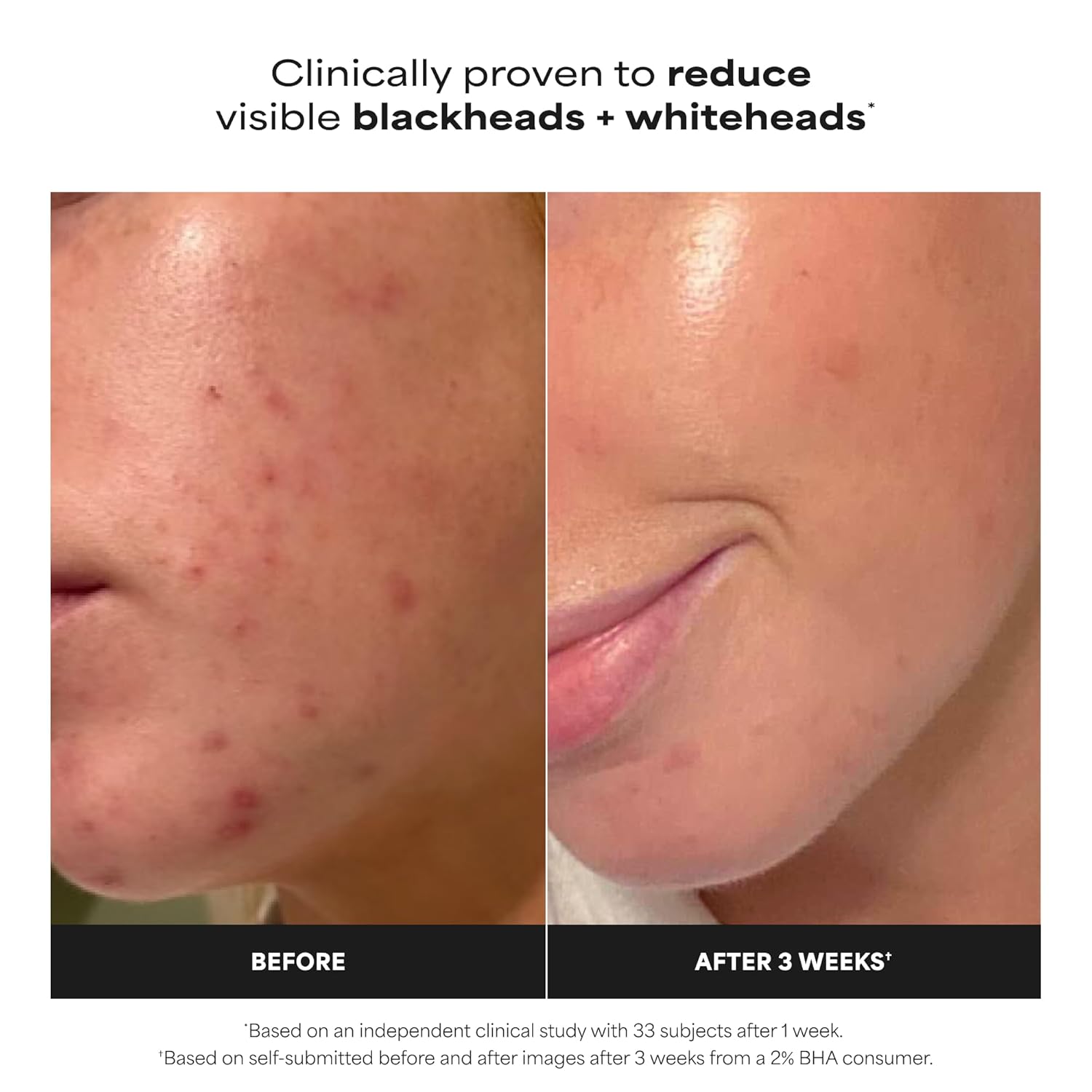 leave-on liquid exfoliant in drop applicator bottle