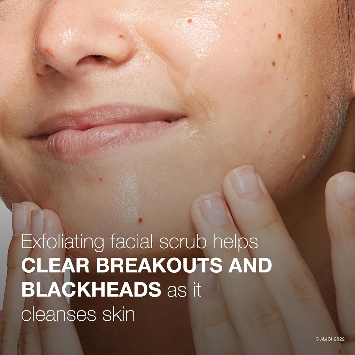 microclear technology for enhanced delivery of acne medication to the source of breakouts