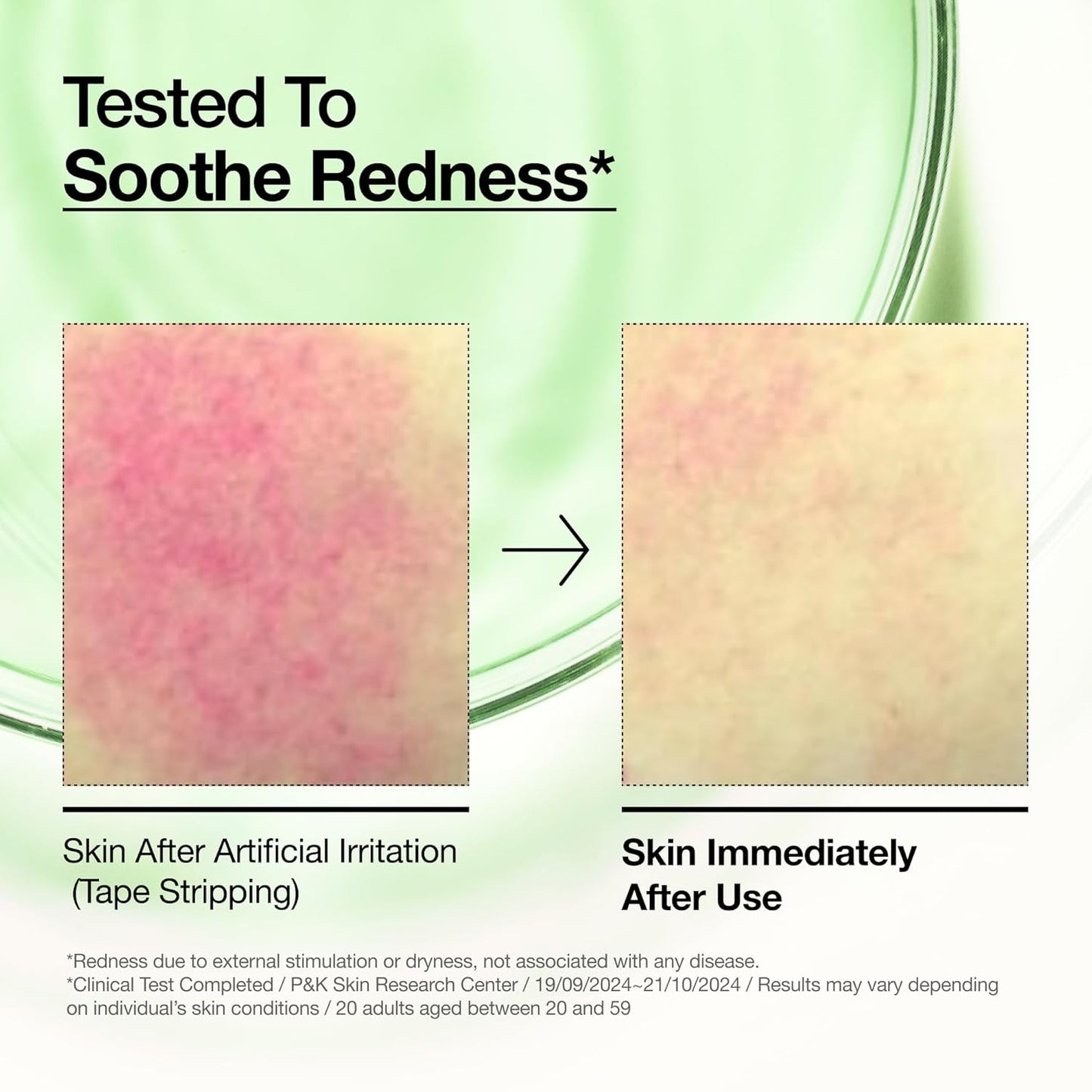naturally derived green tint to visually neutralize redness on application
