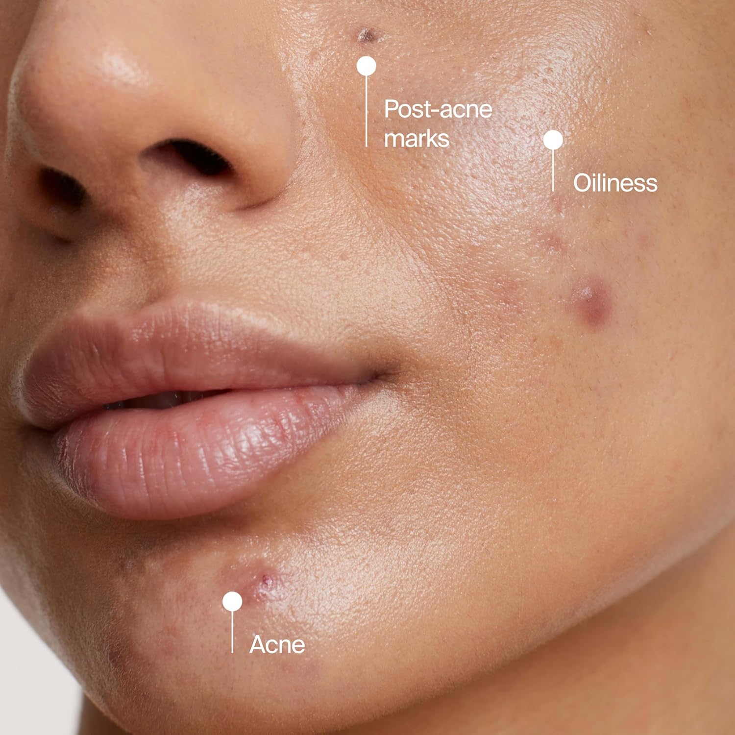 Neutrogena Evenly Clear 2-in-1 Acne Mask & Cleanser – Thoughtful Skincare Gift for Teens and College Students