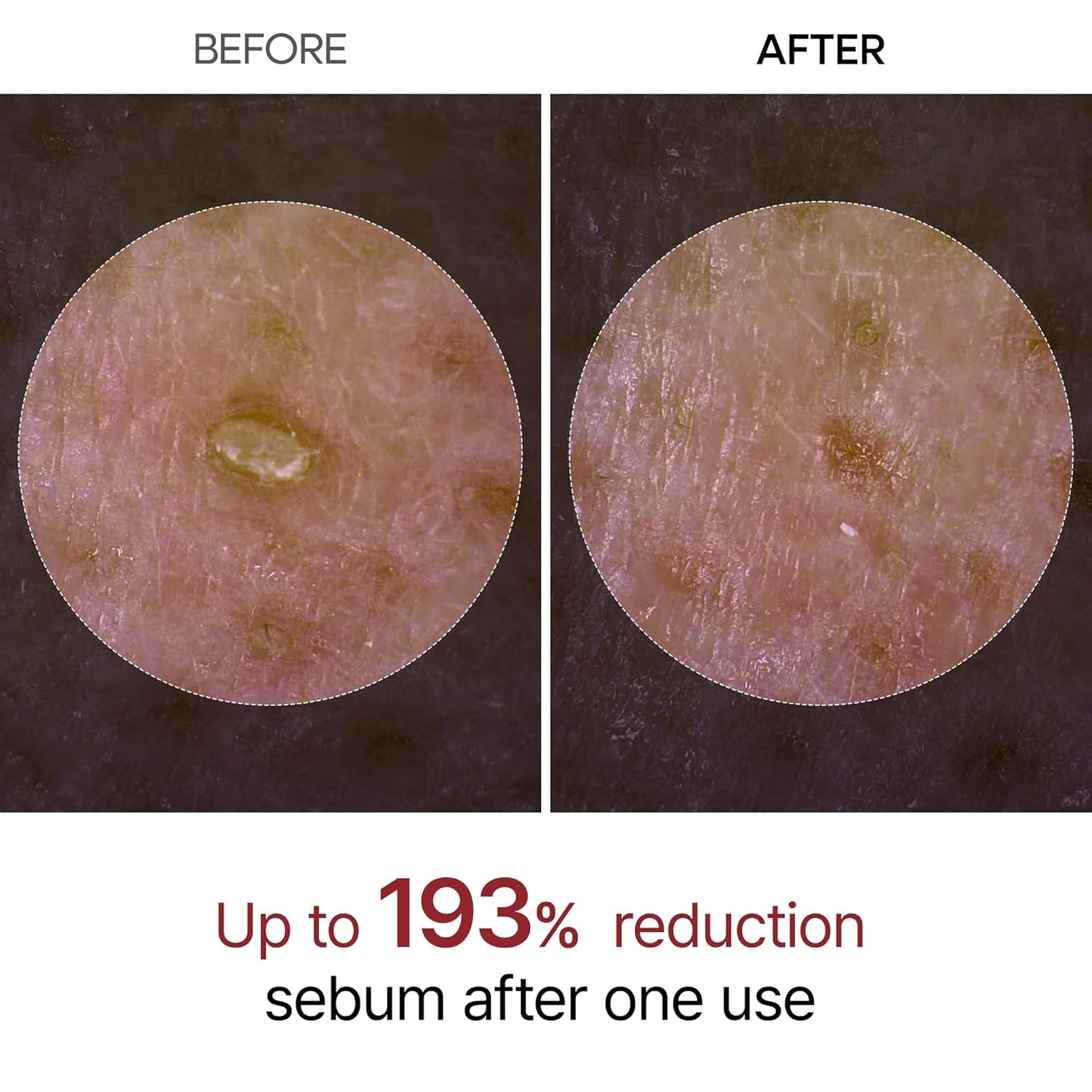 niacinamide for brightening and pore refinement
