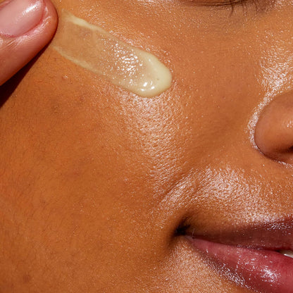 niacinamide to calm, soothe, and improve skin resilience