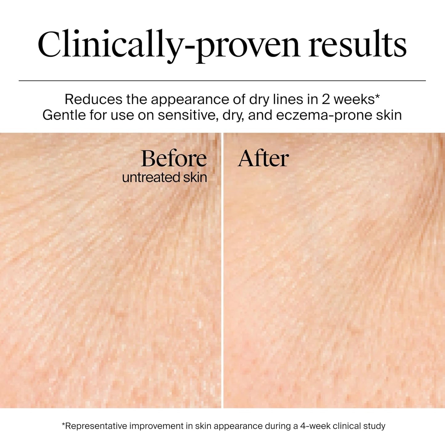 non-comedogenic gel-cream texture that absorbs without greasiness
