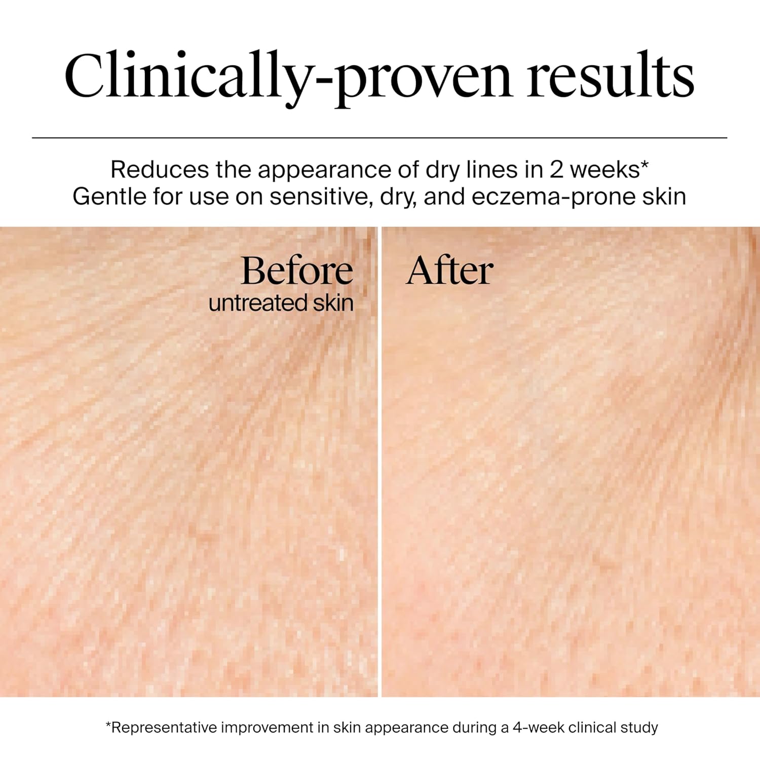 non-comedogenic gel-cream texture that absorbs without greasiness