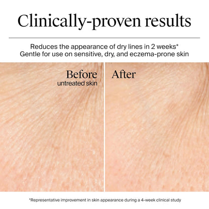 non-comedogenic gel-cream texture that absorbs without greasiness
