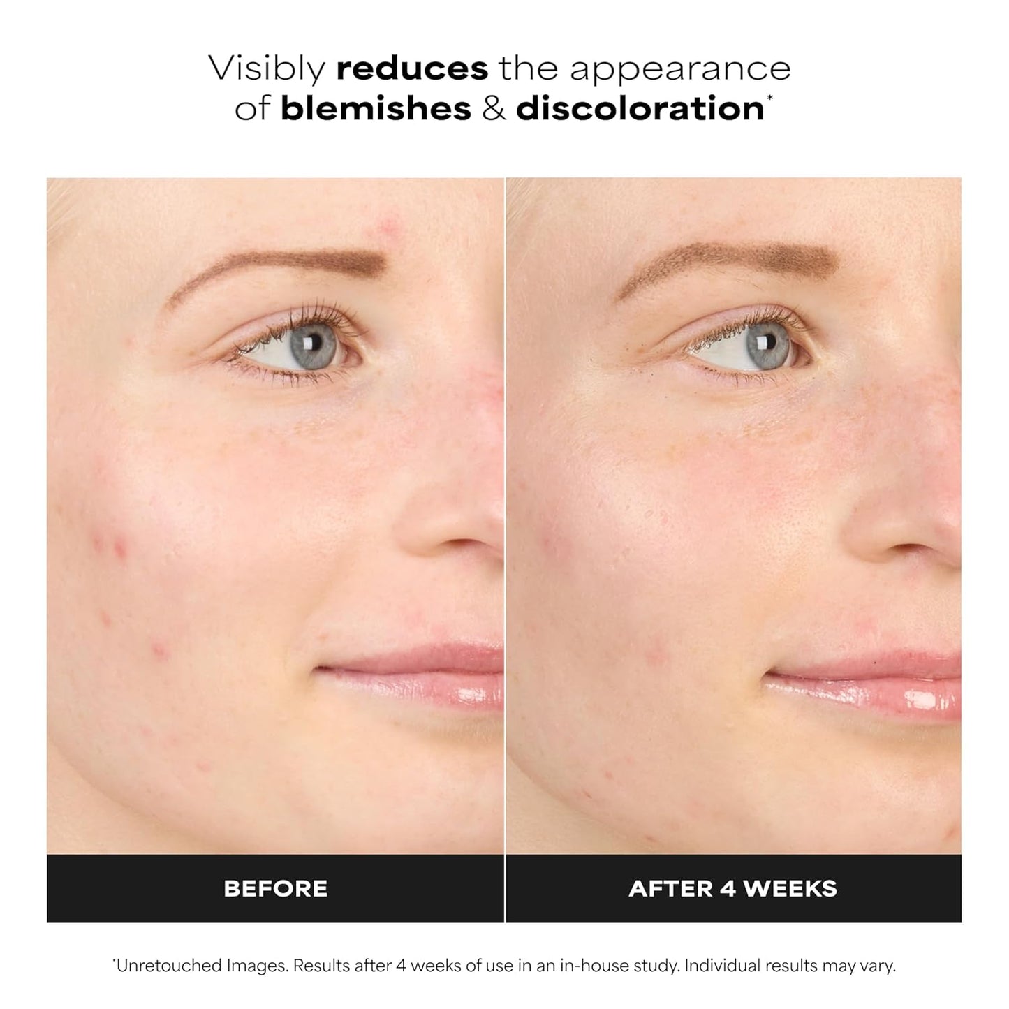 oil-free, fragrance-free cream-gel serum base suitable for sensitive skin