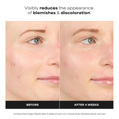 oil-free, fragrance-free cream-gel serum base suitable for sensitive skin