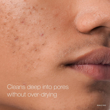 oil-free, non-comedogenic, and unscented formulation