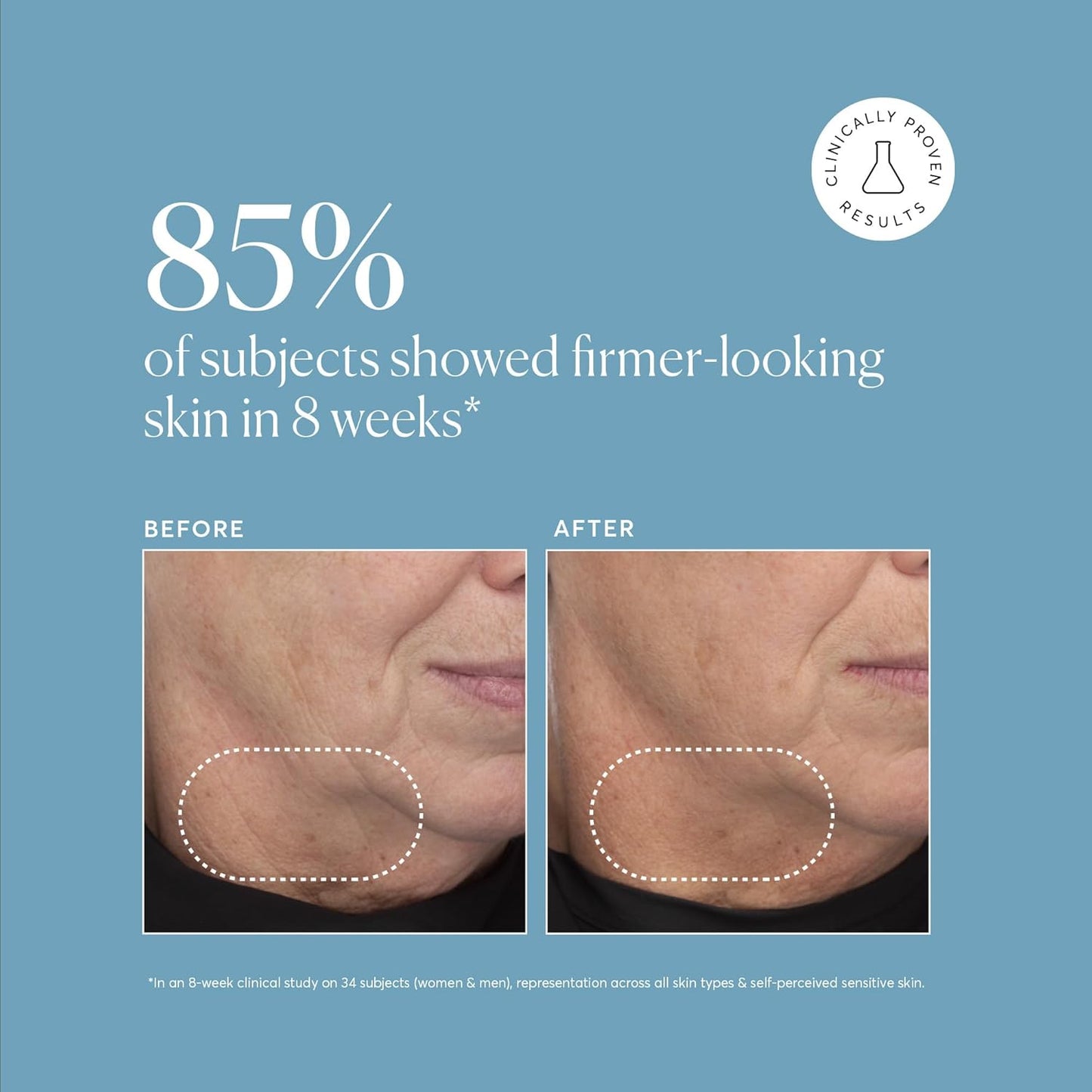 ph-level appropriate formulation suited for aging, combination, and acne-prone skin