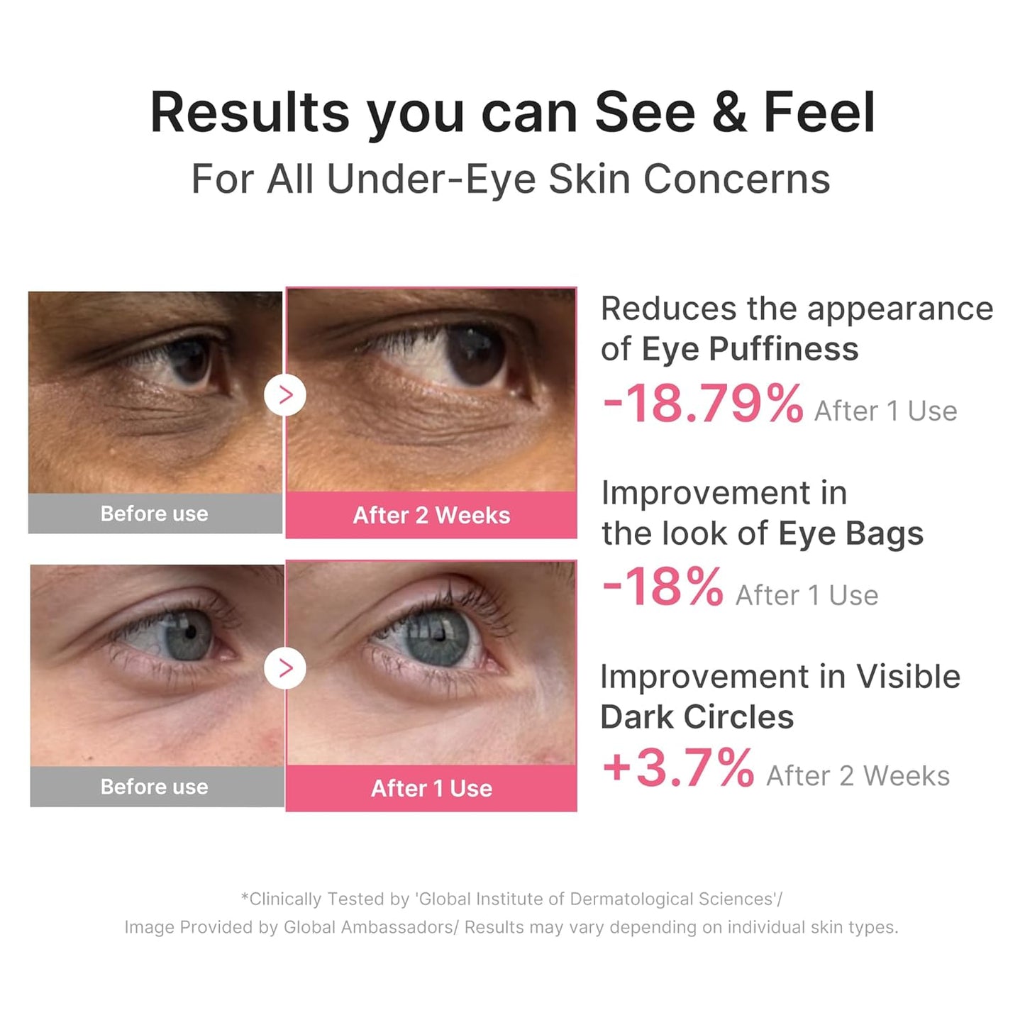 skin-hugging hydrogel patch technology that conforms to curved under-eye contours