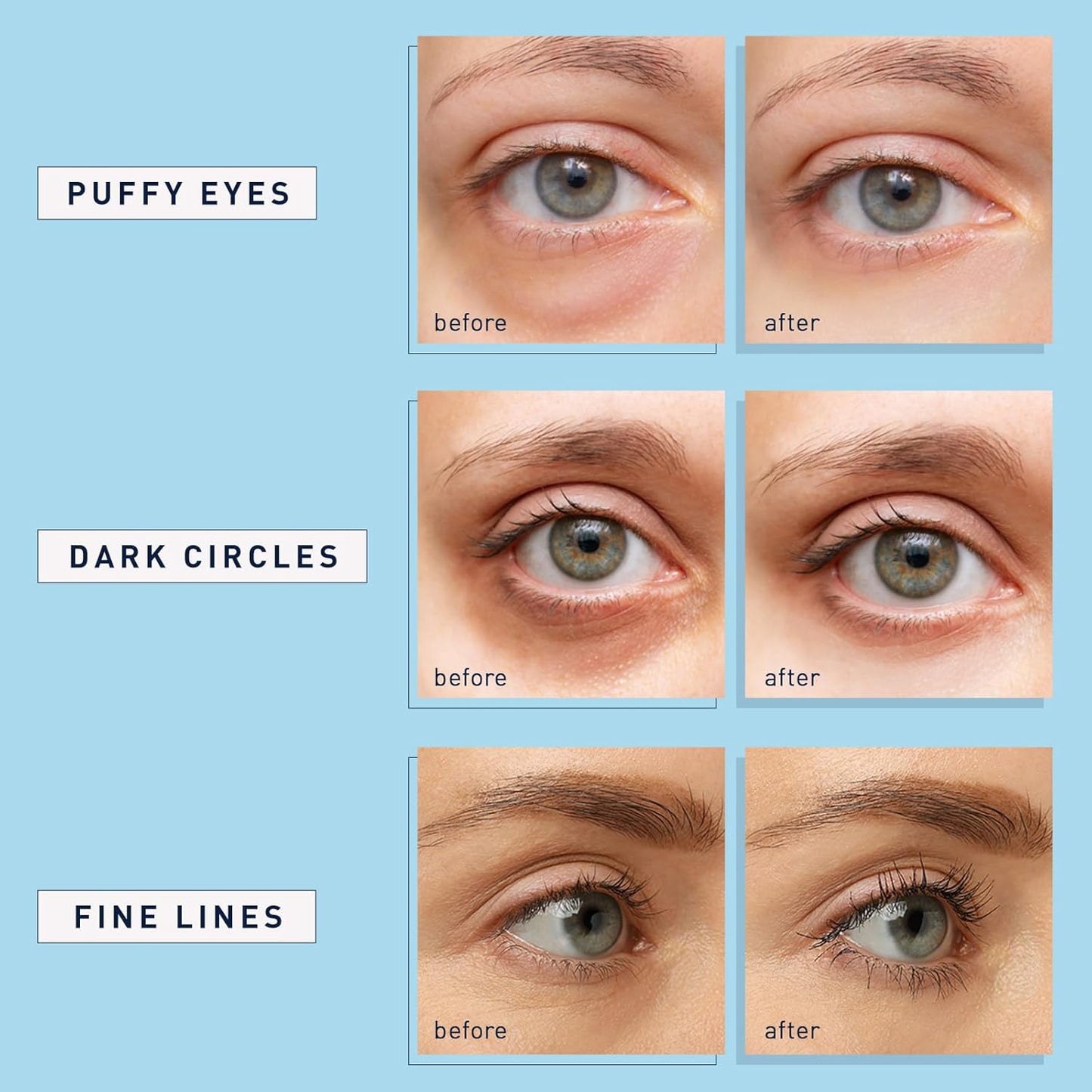suitable for all skin types including dry, oily, normal, sensitive, and combination