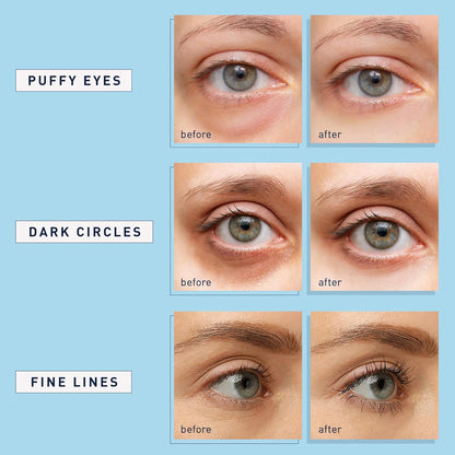suitable for all skin types including dry, oily, normal, sensitive, and combination