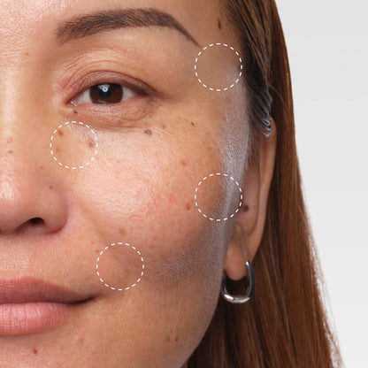 suitable for all skin types with targeted application to hollow or sunken areas