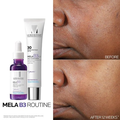 targets multiple discoloration types: sun spots, age spots, liver spots, and post-acne marks