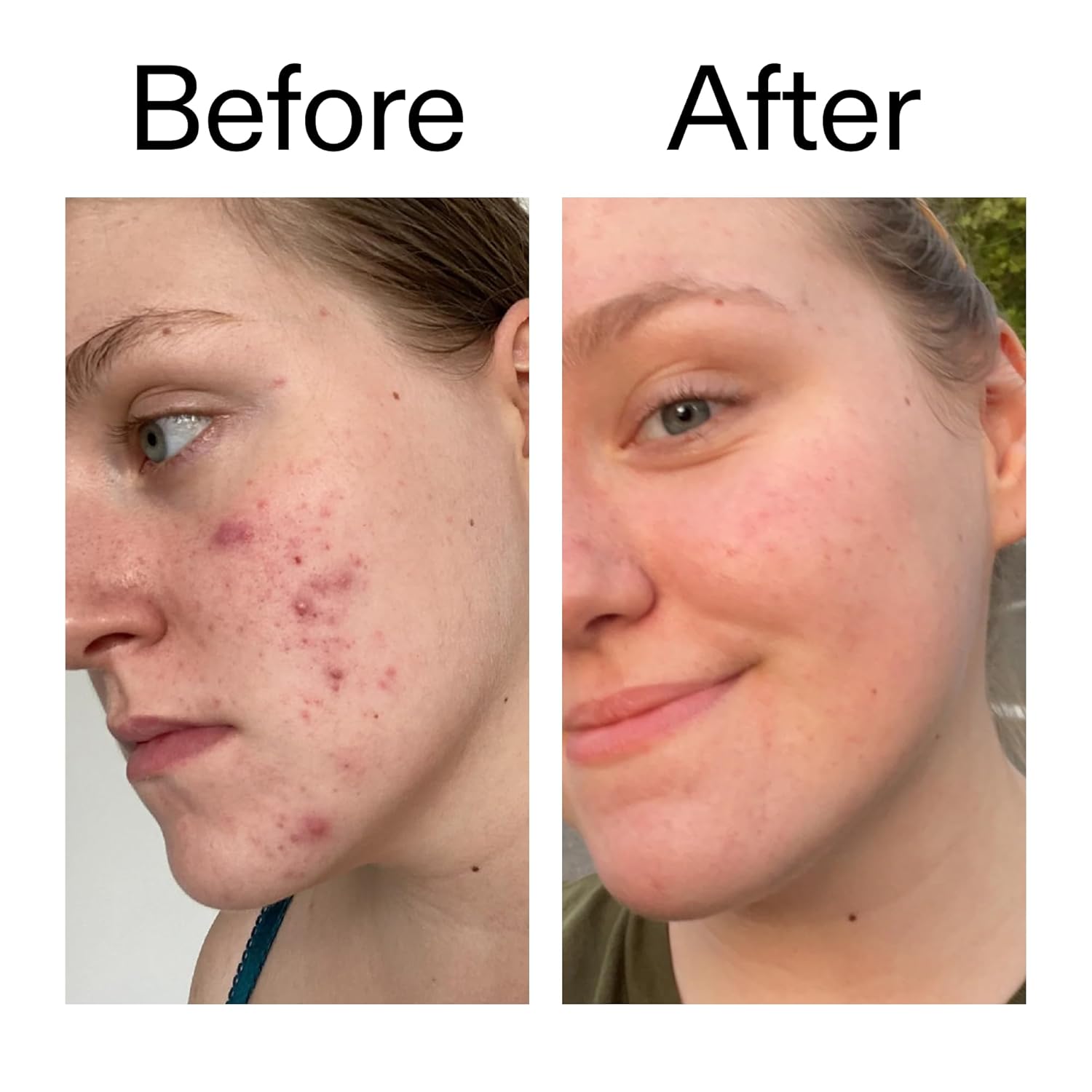 The INKEY List 15% Vitamin C and EGF Serum – Premium Brightening Elixir for an Elevated Skincare Ritual