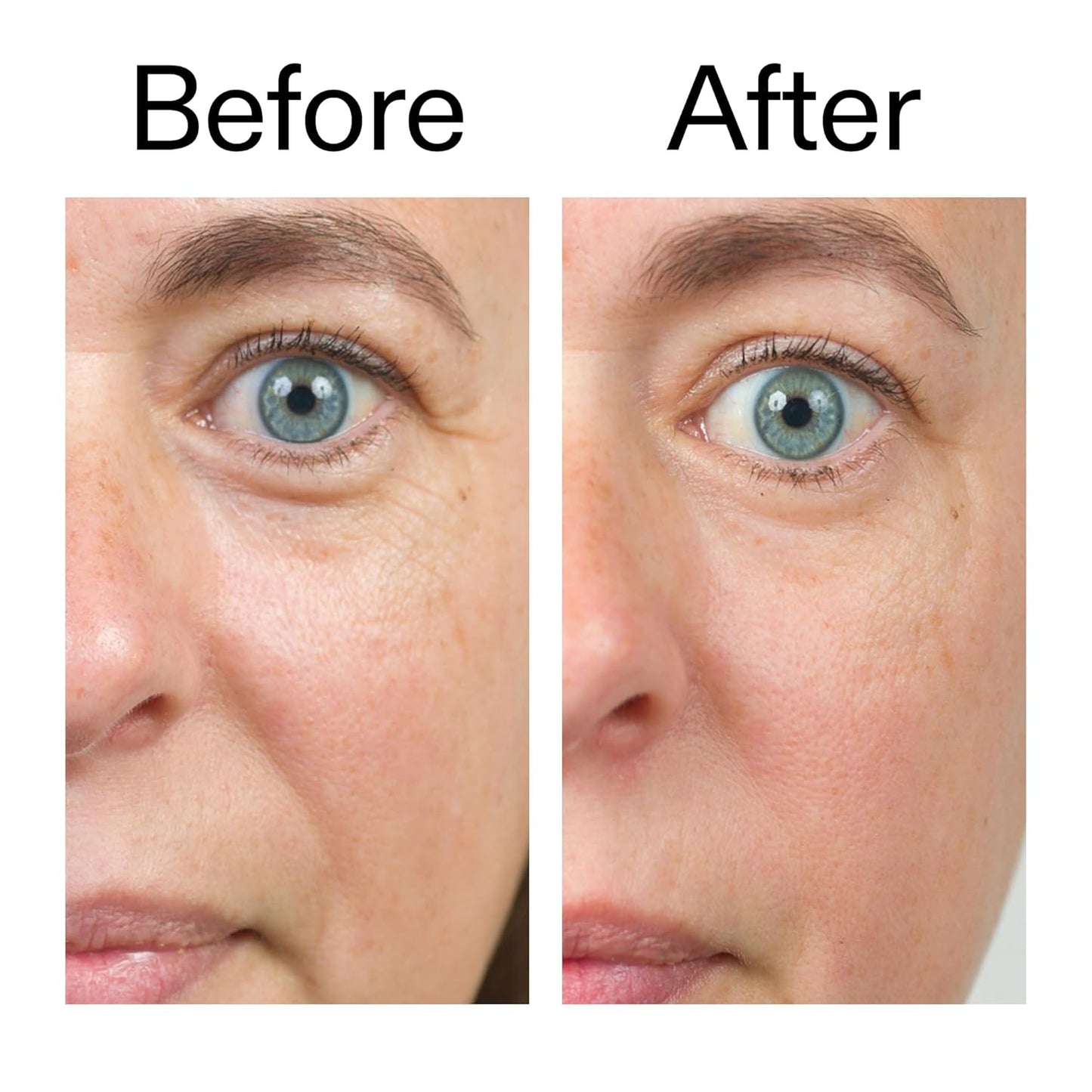 The INKEY List Bio-Active Ceramide Repairing and Plumping Moisturizer, Premium Anti-Aging Cream with Bio-Active Ceramides