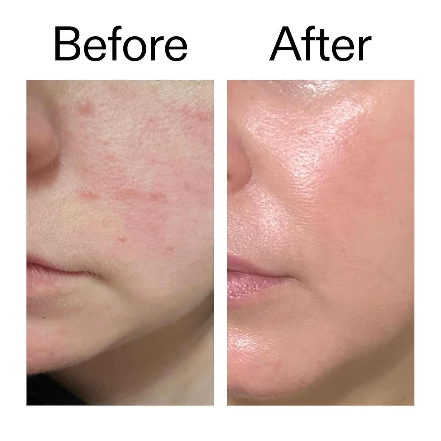 The INKEY List Exosome Hydro-Glow Complex – Premium Anti-Aging Elixir for Vanity Mirror Area, Clinical-Grade Firmness Serum