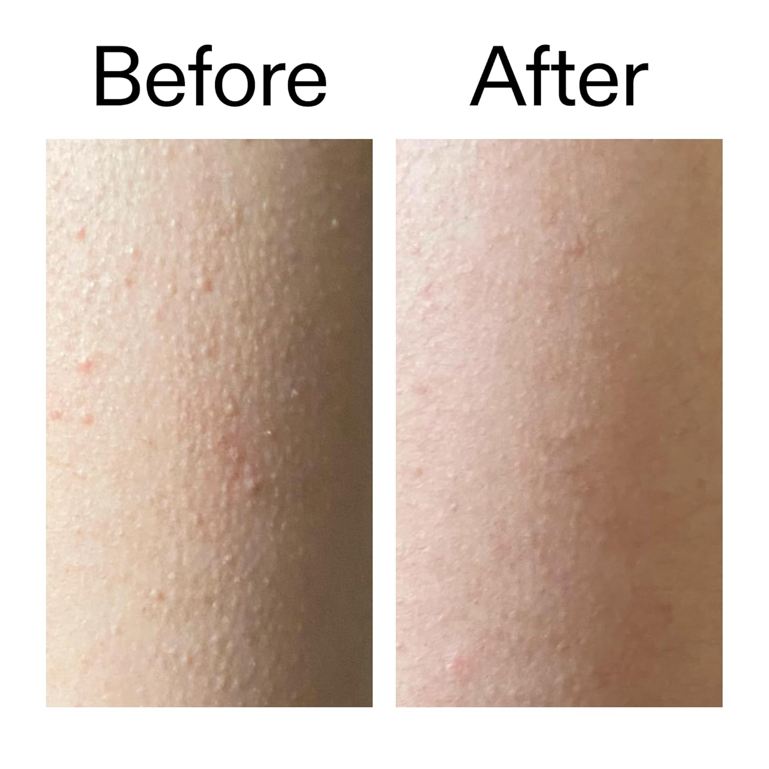 The INKEY List Glycolic Acid Exfoliating Body Stick – Clean Vanity Staple for Effortless Smooth Skin