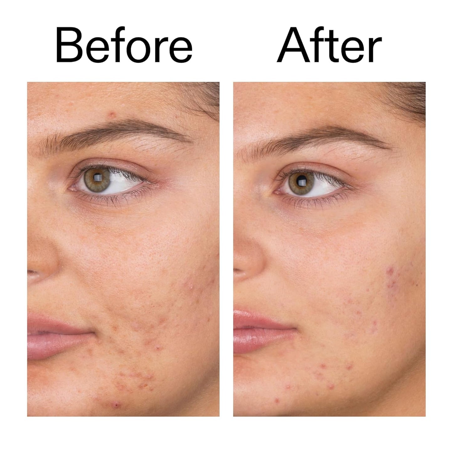 The INKEY List Salicylic Acid Cleanser - Simple Daily Wash for Uncluttered Bathroom Counters