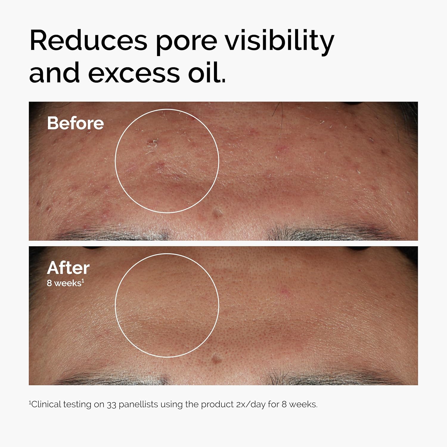 the ordinary brand recognition for clinical, transparent ingredients at accessible pricing