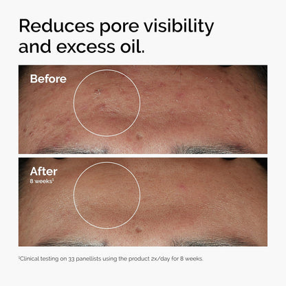 the ordinary brand recognition for clinical, transparent ingredients at accessible pricing