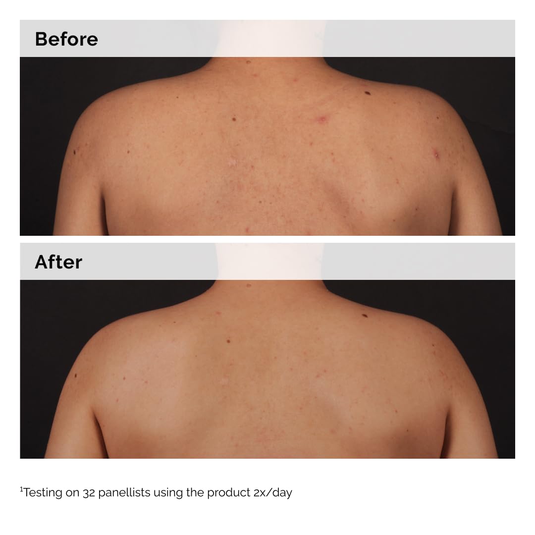 The Ordinary Salicylic Acid 0.5% Body Serum – Streamlined Vanity Essential for Clear, Uncluttered Skin