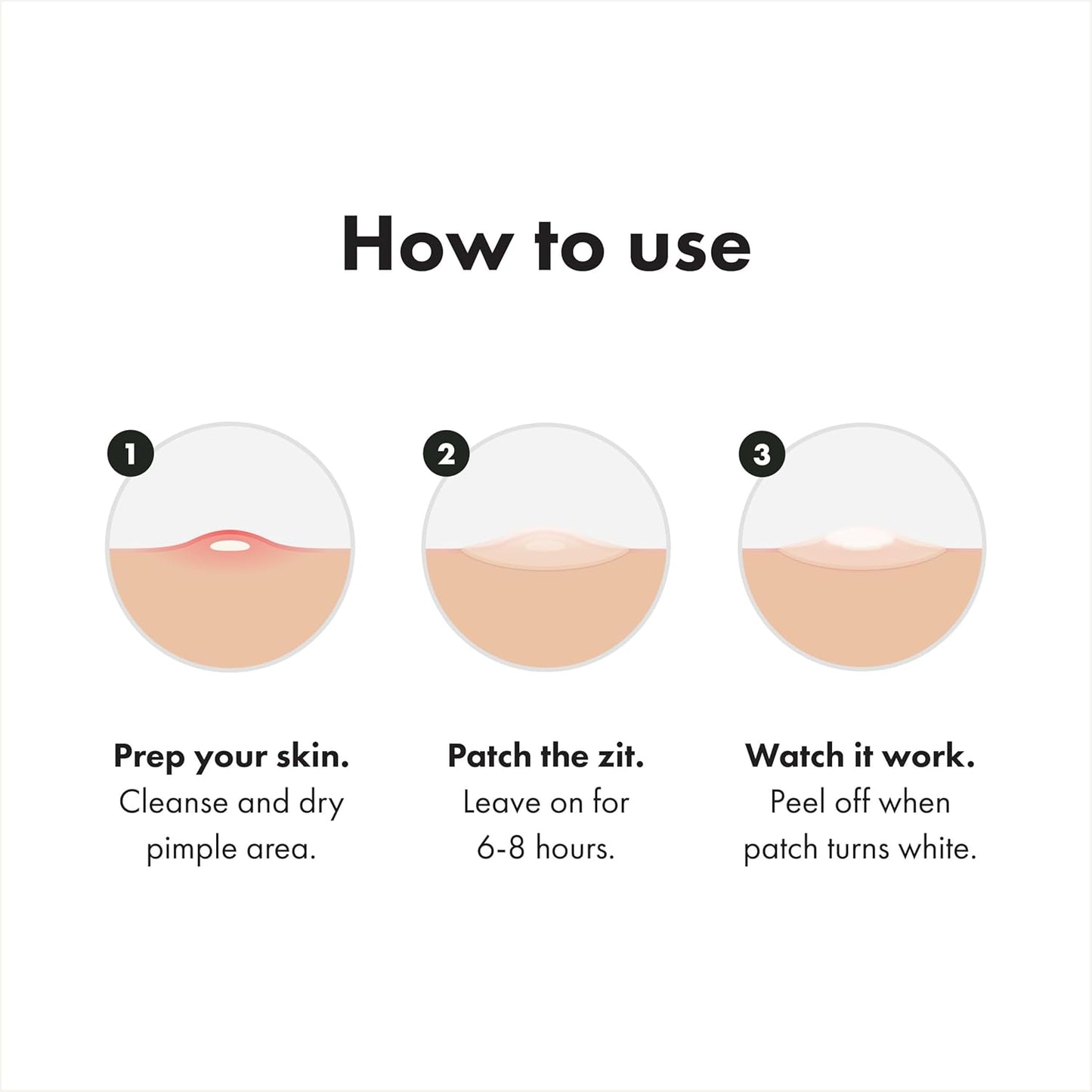 three patch types per box: 12 original, 12 invisible+, and 2 surface for varied pimple needs