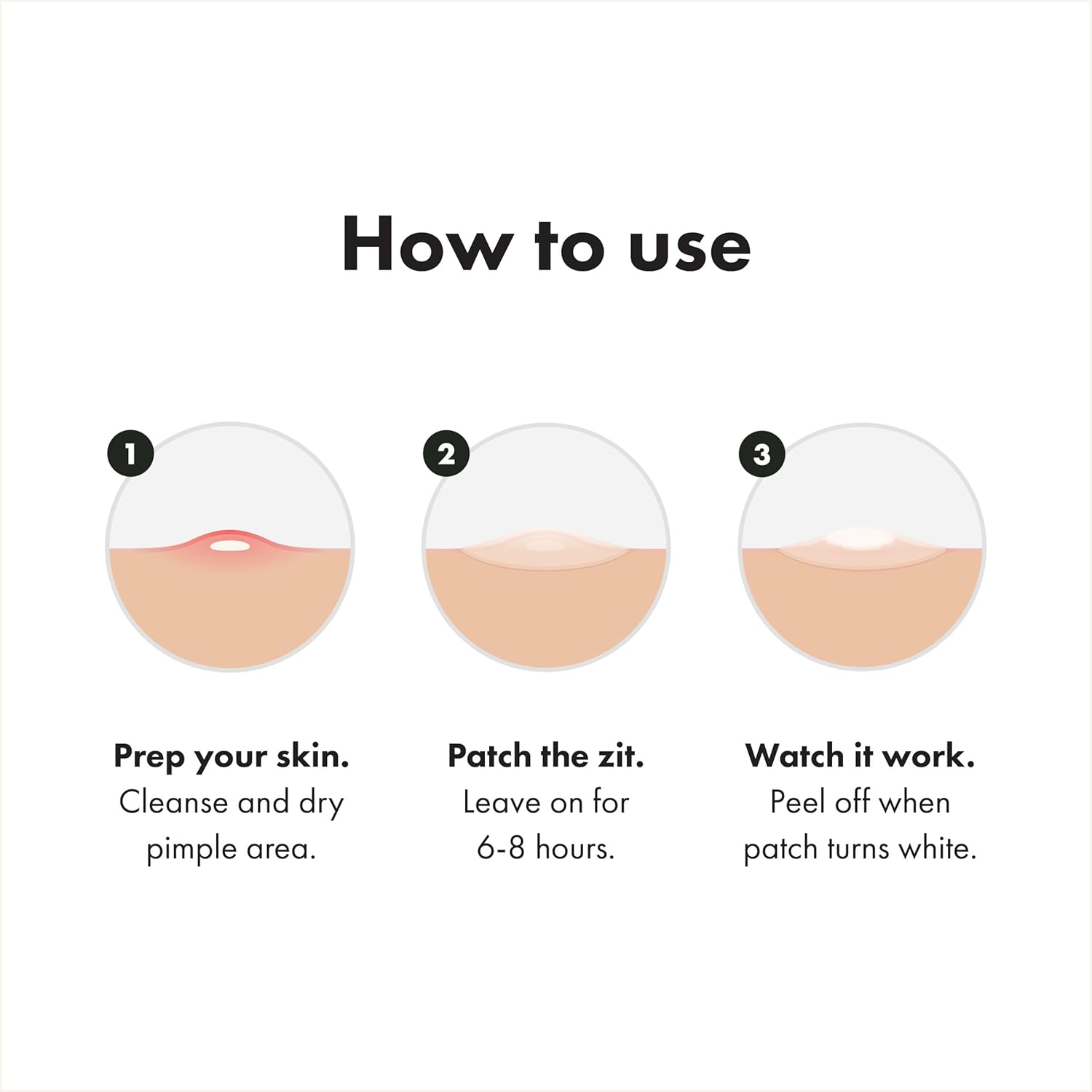 three patch types per box: 12 original, 12 invisible+, and 2 surface for varied pimple needs