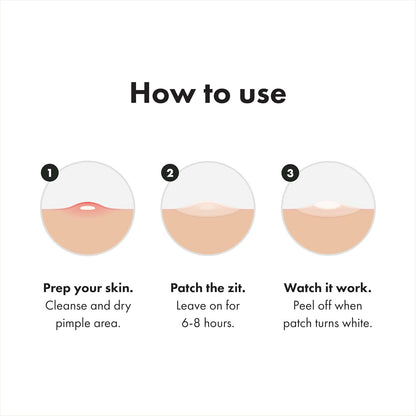 three patch types per box: 12 original, 12 invisible+, and 2 surface for varied pimple needs