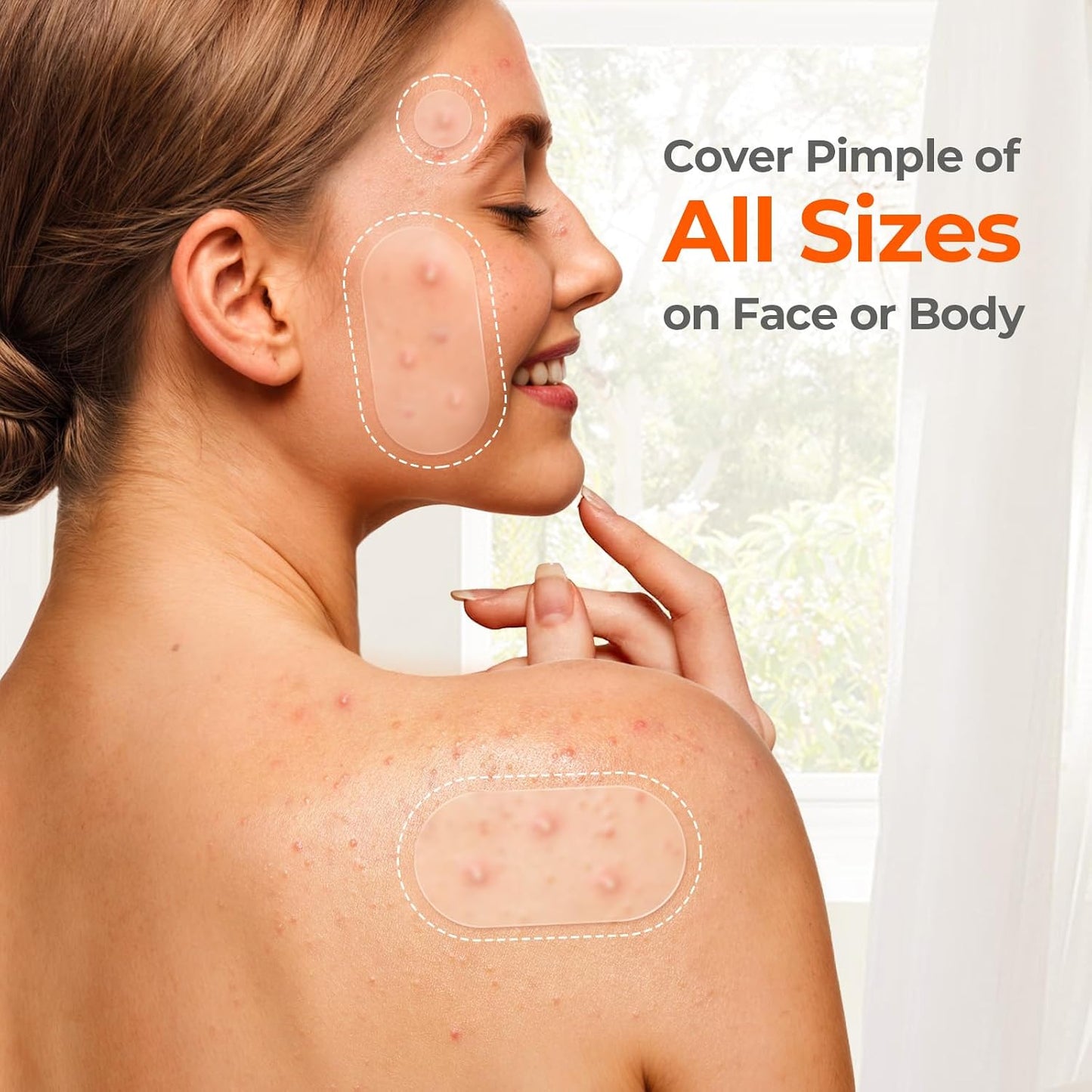 TKTK 443 Count Acne Patches – Teen-Friendly Spot Treatment for Dorm Room and School Backpack