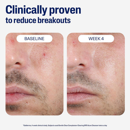 unscented, dermatologist-tested, suitable for acne-prone, dry, oily, normal, mature and sensitive skin