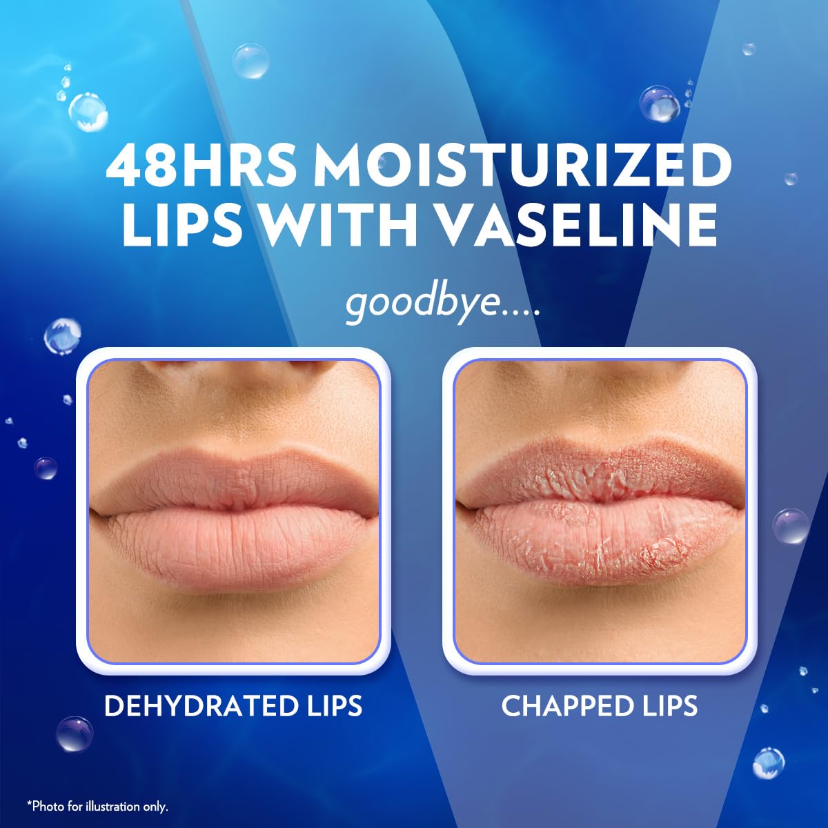 Vaseline Lip Therapy Original Care – Camping and Hiking Wind-Burn Defense, Pocket Travel Balm 6-Pack