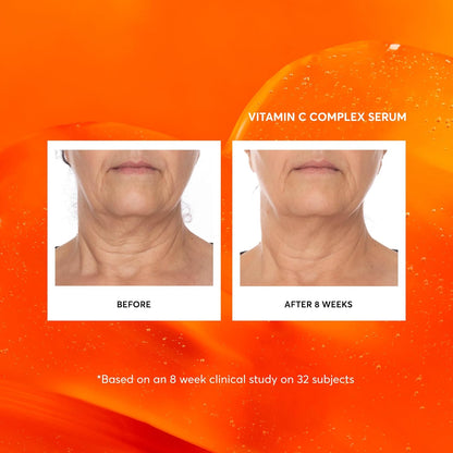 vitamin e antioxidant to support skin barrier and complement vitamin c